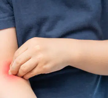 erb's palsy lawsuit