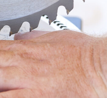 If I Get Injured at Work, Can I Sue My Employer? | Workers Compensation Attorneys